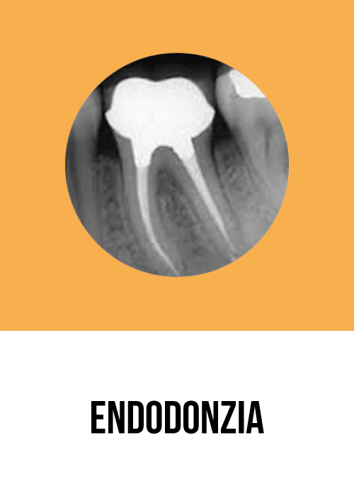 Endodonzia