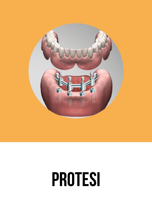 Protesi